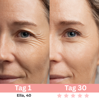 7-in-1 EMS Gesichtsstraffer