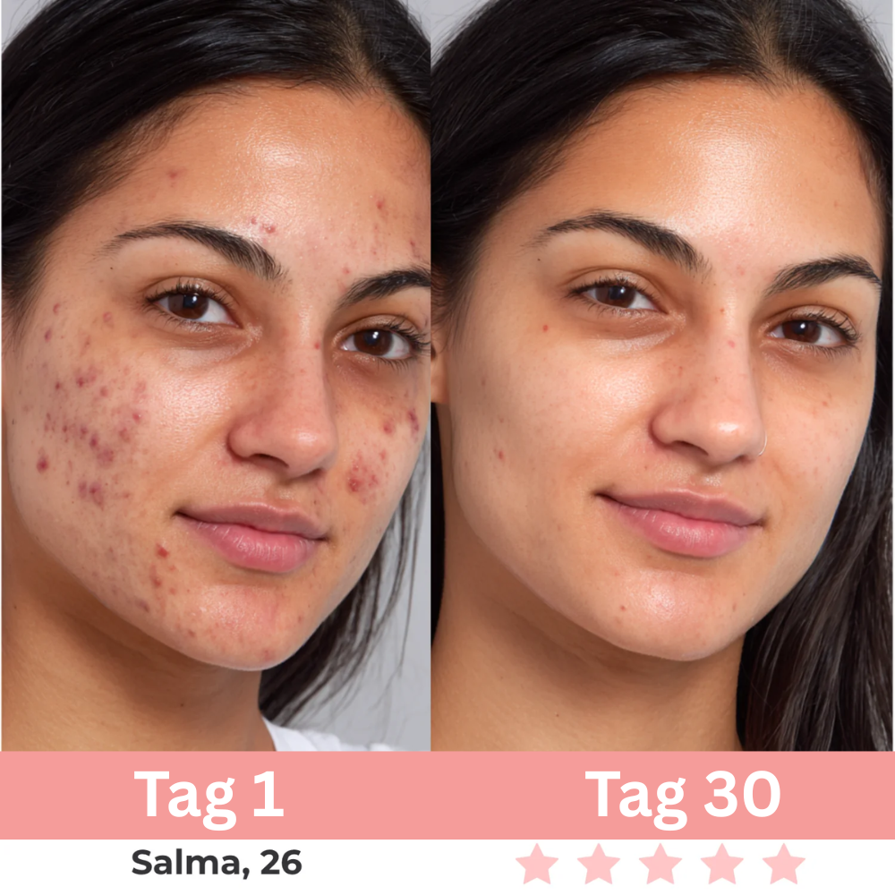 7-in-1 EMS Gesichtsstraffer