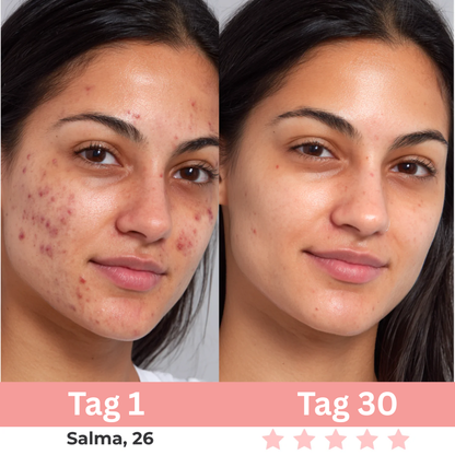 7-in-1 EMS Gesichtsstraffer